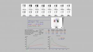 Rostocker Nuklearmedizin Baier - Nierenzintigraphie